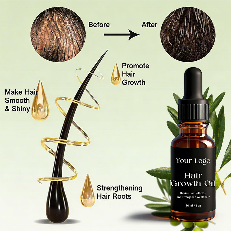 Custom Logo Private Label 30ml Hair Growth Oil Naturals Anti-Hair Loss Oil Super Fast Hair Care Repair Liquid