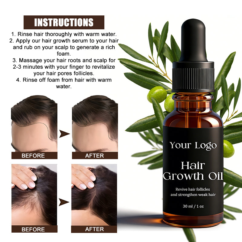 Custom Logo Private Label 30ml Hair Growth Oil Naturals Anti-Hair Loss Oil Super Fast Hair Care Repair Liquid